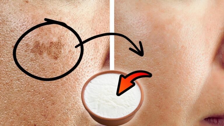 Dieser einfache Scrub verwandelt lästige Altersflecken in strahlende Haut… Hier ist wie!