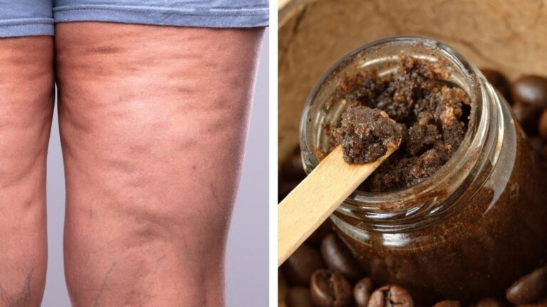 Dieser einfache Kaffee-Trick verwandle deine Haut und reduziere Cellulite und